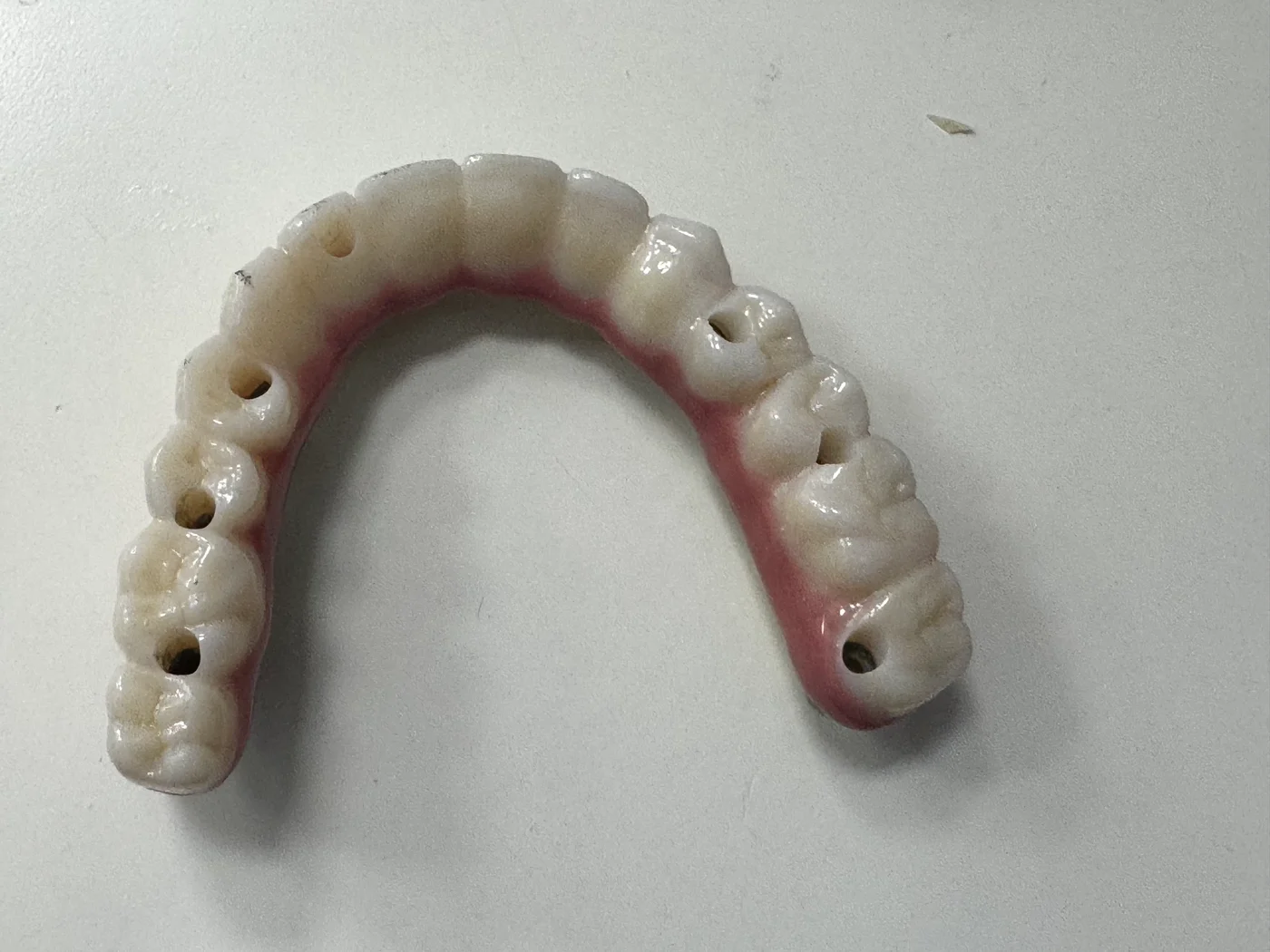 Fixed full-arch zirconia prosthesis made at Centre Dental, screw-retained on four to six implants — Chinatown NYC