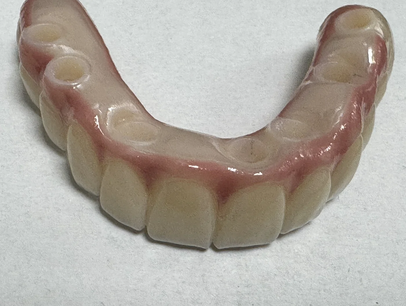 Underside of a completed All-on-X full-arch prosthesis made at Centre Dental
