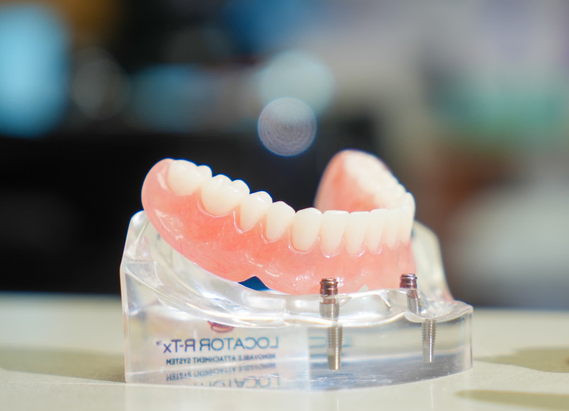 纽约种植体支持式覆盖义齿 | Centre Dental - 由种植体固定的可摘覆盖义齿 — 日后可转换为固定式覆盖义齿