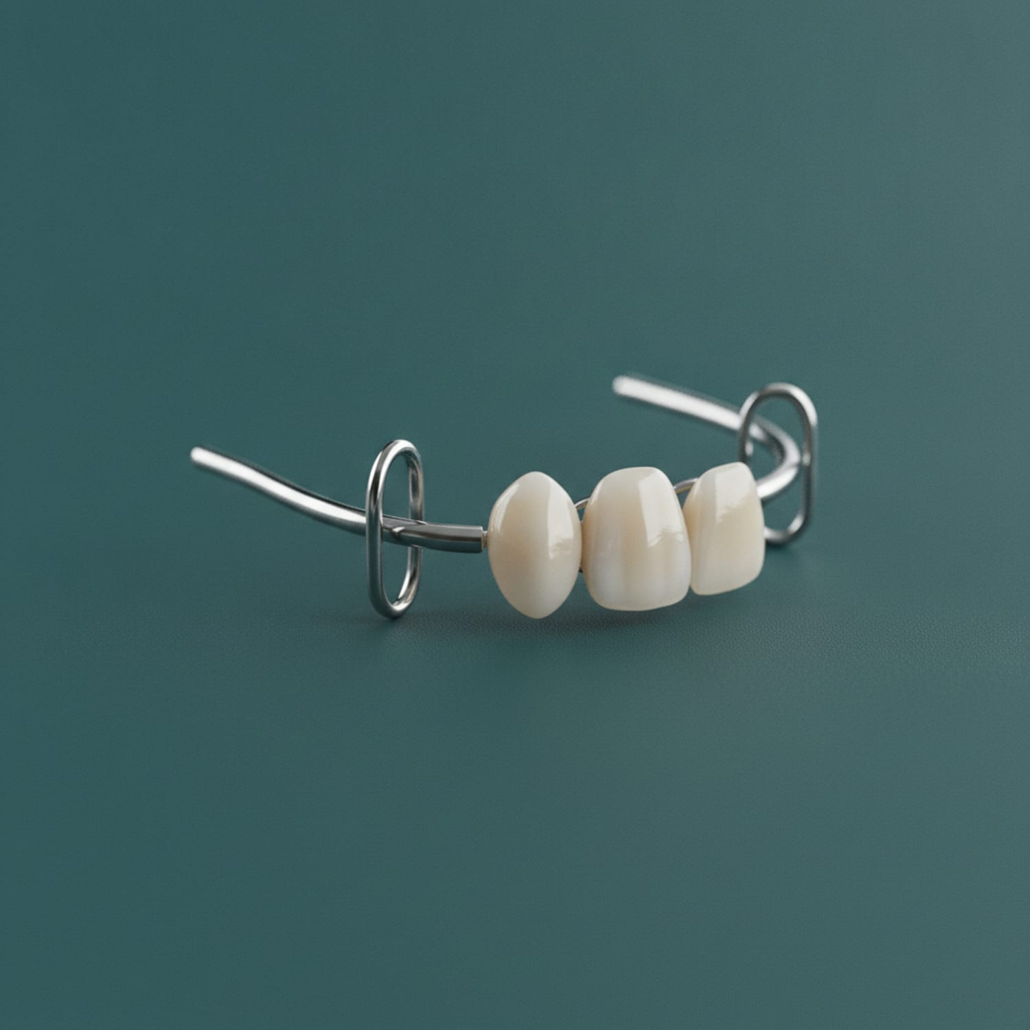 A removable partial denture with a metal framework — Centre Dental NYC