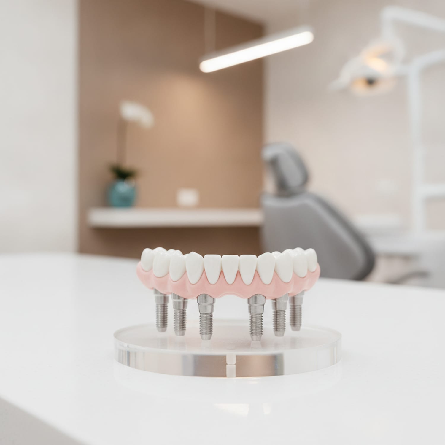 Full-arch implant bridge model supported by titanium implants — Centre Dental NYC